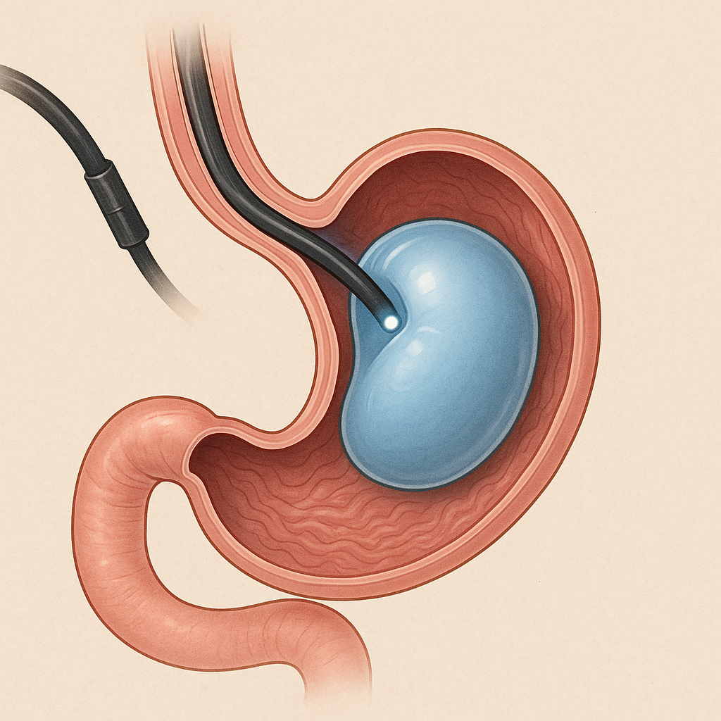 Beyond Surgery: Endoscopic Bariatric Therapies Are Transforming Weight Loss